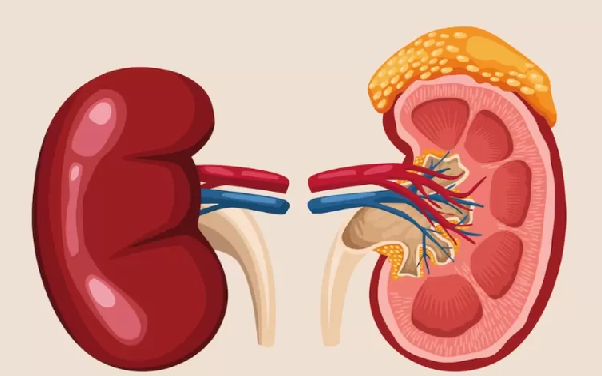 10 Cara Merawat Ginjal Agar Terhindar dari Berbagai Penyakit, Kuncinya Konsisten!