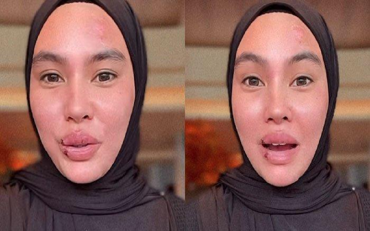 Kartika Putri Sedih Melihat Komentar Netizen yang Hujat Penyakitnya: Kok Orang-orang Tega Ya