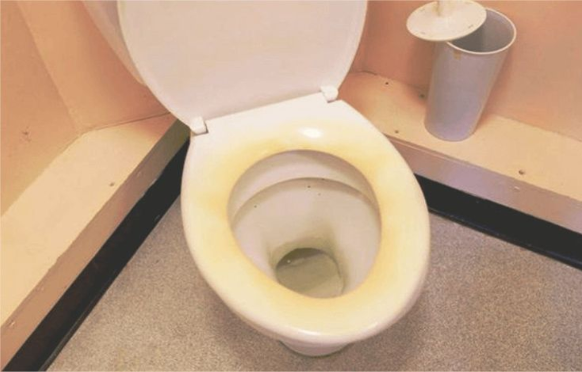 Cara Ampuh Membersihkan Lubang WC yang Berkerak Dalam Sekejap!