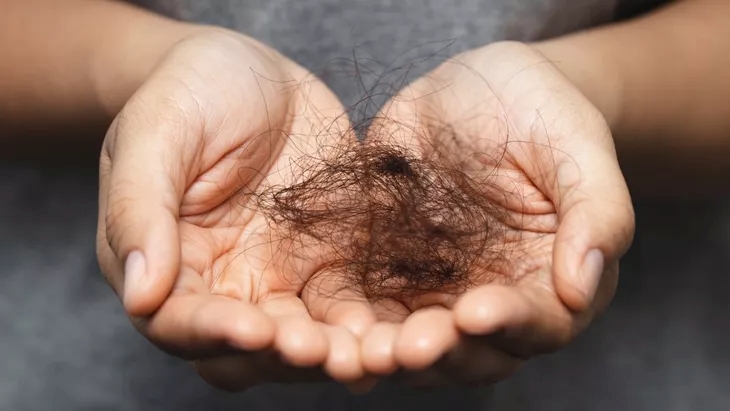 Remaja 16 Tahun Muntah Seharian, Usai Operasi Dokter Temukan Gumpalan Rambut 1,5 Kg
