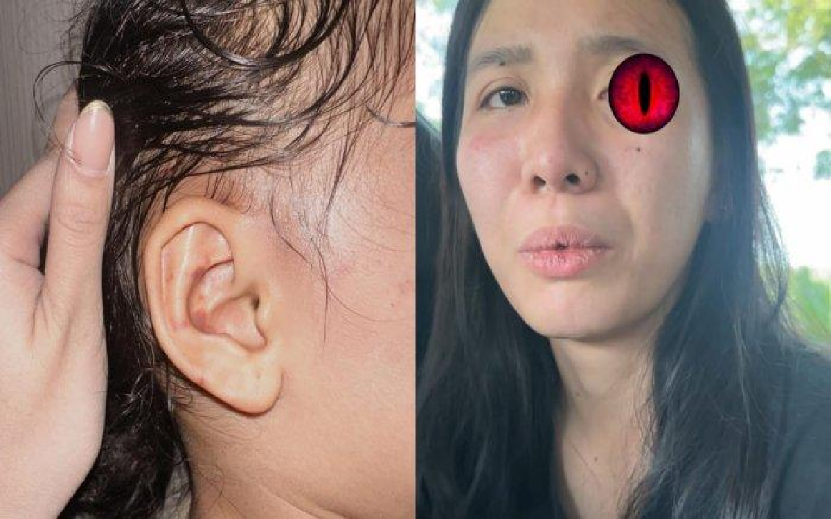 Terungkap! Anak Emy Aghnia Disiksa 1 Jam Tanpa Henti, Siraman Minyak Kutus-kutus Panas Makin Pedih