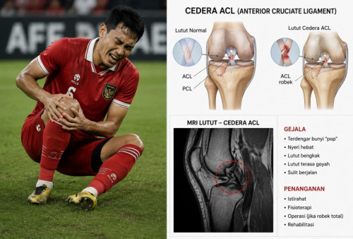 Waspada Cedera ACL: Detik-detik yang Bisa Menghancurkan Karier Atlet Profesional Seketika