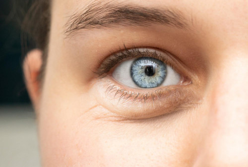 7 Cara Efektif Menghilangkan Kantung Mata yang Bikin Ganggu Penampilan