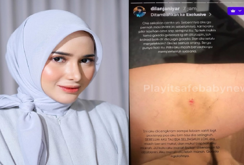 Dilan Janiyar Blak-blakan Klaim Pernah Dikasari Safno: Lebam Ditangan Jadi Bukti!