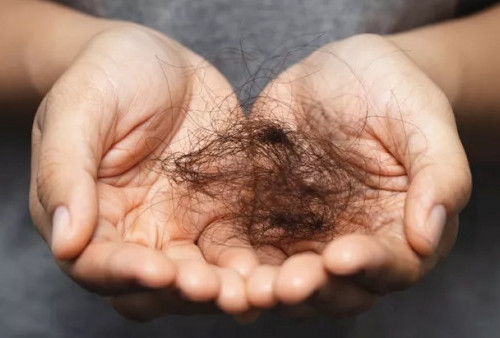 Remaja 16 Tahun Muntah Seharian, Usai Operasi Dokter Temukan Gumpalan Rambut 1,5 Kg