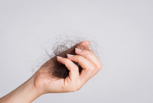 4 Cara Mudah Atasi Rambut Rontok dengan Bahan Alami, Pokoknya Anti Pitak!