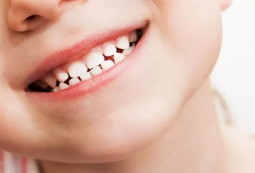 8 Cara Merawat Gigi Anak Agar Tidak Rusak dan Berlubang