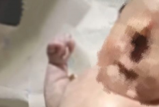 VIRAL! Seorang Bayi Lahir Bermata Satu di Muba Sumatera Selatan, Kok Bisa?