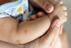 6 Cara Menghilangkan Bekas Gigitan Nyamuk Pada Kulit Bayi