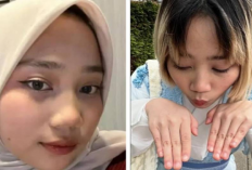 Putri Kang Emil Lepas Hijab Usai Keluar dari ITB, Efek Pergaulan?
